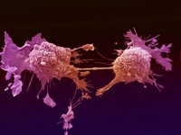 Lung-cancer-cells.jpg